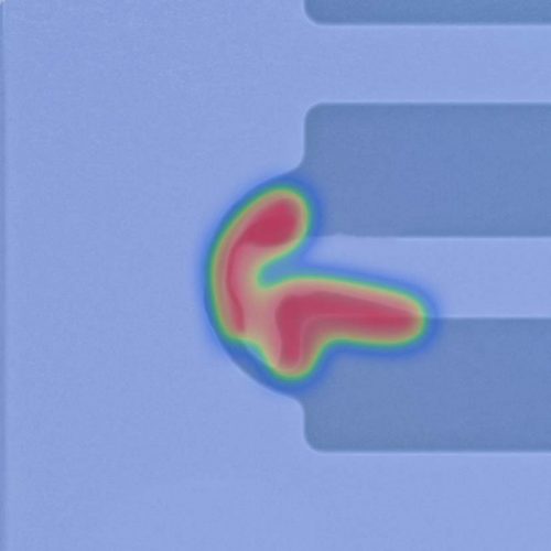 Microstructure microfluidics lab-on-a-chip anomaly detection